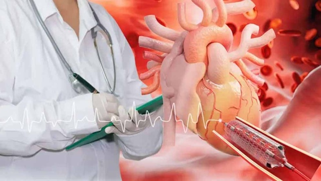 হার্টের ১১ ধরনের রিংয়ের দাম কমালো সরকার