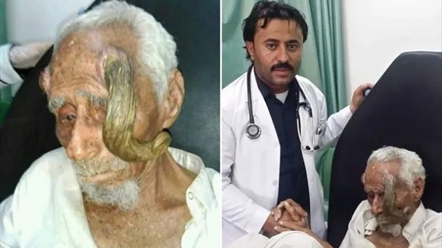 মাথার দুটি শিং কাটতে গিয়েই মৃত্যু হলো ১৪০ বছরের 'গোট ম্যানের'