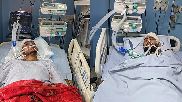 দুই শিক্ষার্থী লাইফ সাপোর্টে, একজনকে পাঠানো হয়েছে ঢাকায়
