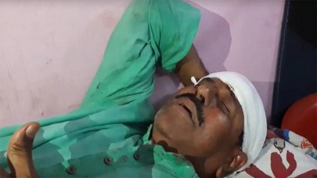 পশ্চিমবঙ্গের মন্ত্রীর মাথা ফাটিয়ে দিয়েছে বিজেপি