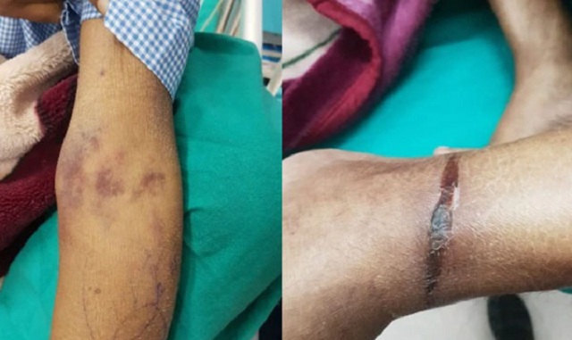 আইসিইউ‌তে রোগীর হাত-পা বেঁধে চিকিৎসা!