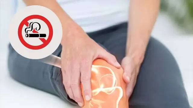 ধূমপান শুধু ফুসফুস নয়, ডেকে আনছে বাতের ব্যথা
