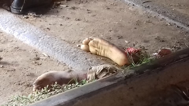 CU student loses legs under shuttle train