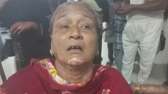 চট্টগ্রামে যেভাবে চালানো হলো পেট্রোলবোমা হামলা, দগ্ধ ২