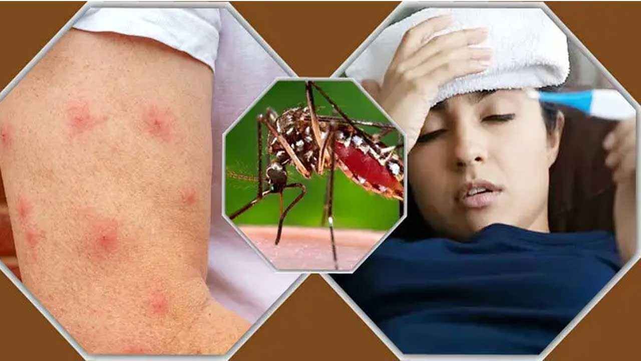 কিউবায় চিকুনগুনিয়া ও ডেঙ্গুতে ৩৩ জনের মৃত্যু, ২১ শিশু আক্রান্ত