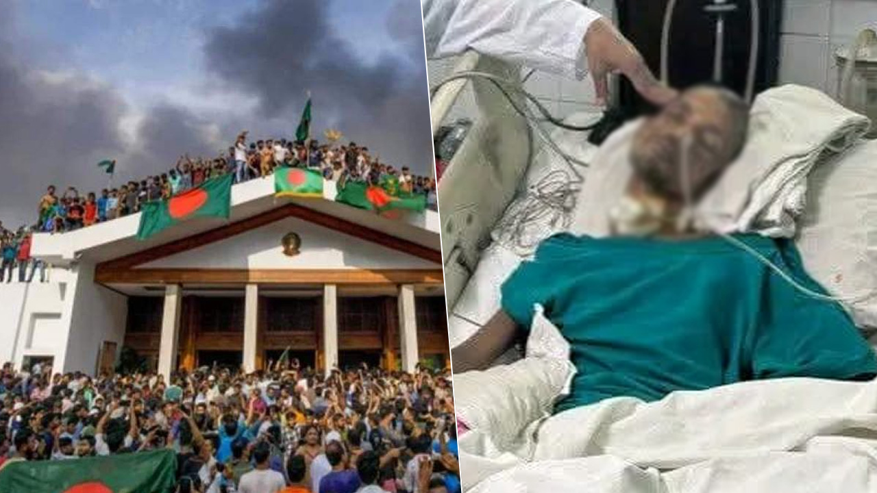 দেড় বছর পর মাথায় গুলিবিদ্ধ জুলাই যোদ্ধা আশরাফুলের মৃত্যু