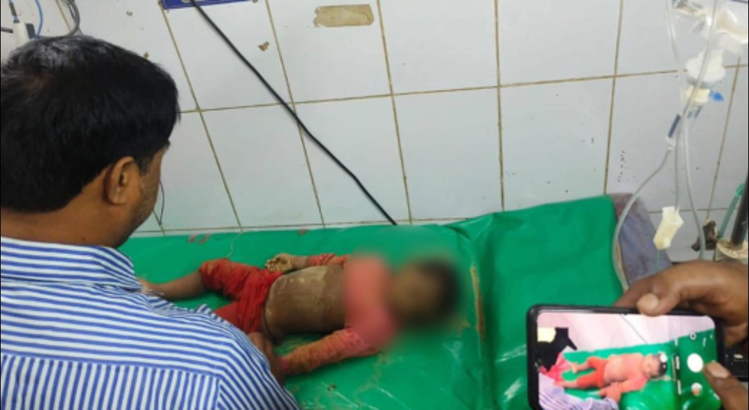 শিশু সাজিদ কখন মারা গেছে, যা বললেন চিকিৎসক