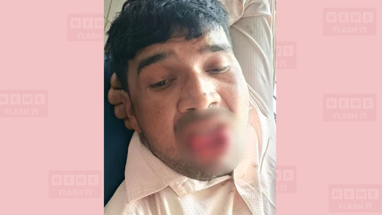জোর করে চুম্বনের চেষ্টা, আত্মরক্ষায় তরুণীর কামড়ে অতপর...