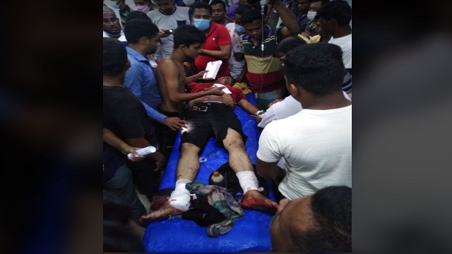 আমতলীতে দুর্বৃত্তদের হামলায় দুইজন আশঙ্কাজনক, হাত - পায়ে মারাত্মক জখম
