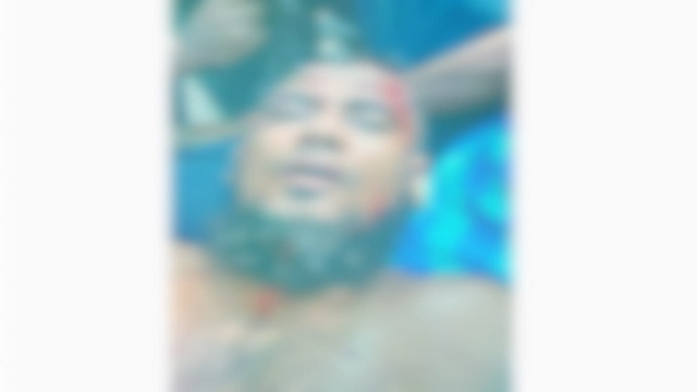 ফকিরহাটে ভাইয়ের কোপে ভাই গুরুতর জখম