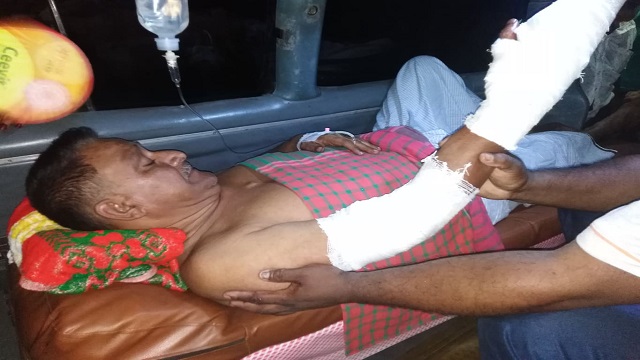 দুর্বৃত্তদের হামলায় মারাত্মকভাবে জখম