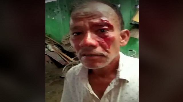 সৈয়দপুরে জমি নিয়ে বিরোধের জেরে চাচাতো ভাইকে হত্যার চেষ্টা