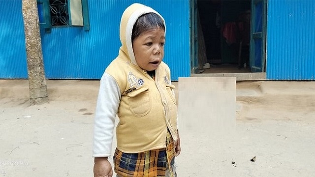 দেশের সবচেয়ে ‘খাটো মানুষ’ফেনীর রিশাত!