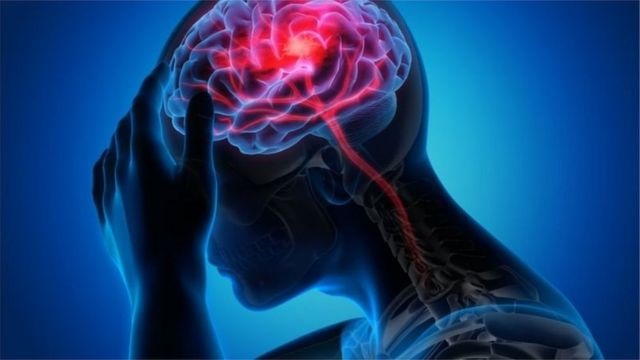 স্ট্রোকের ঝুঁকি থেকে বাঁচবেন যেভাবে