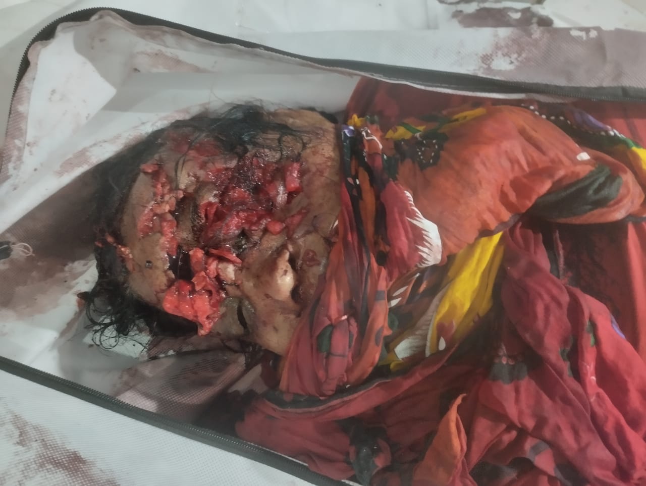 এক মাসেও সুরাহা হয়নি সোনারগাঁও হোটেলের সামনে থেকে উদ্ধার হওয়া নারীর ক্ষতবিক্ষত মরদেহের