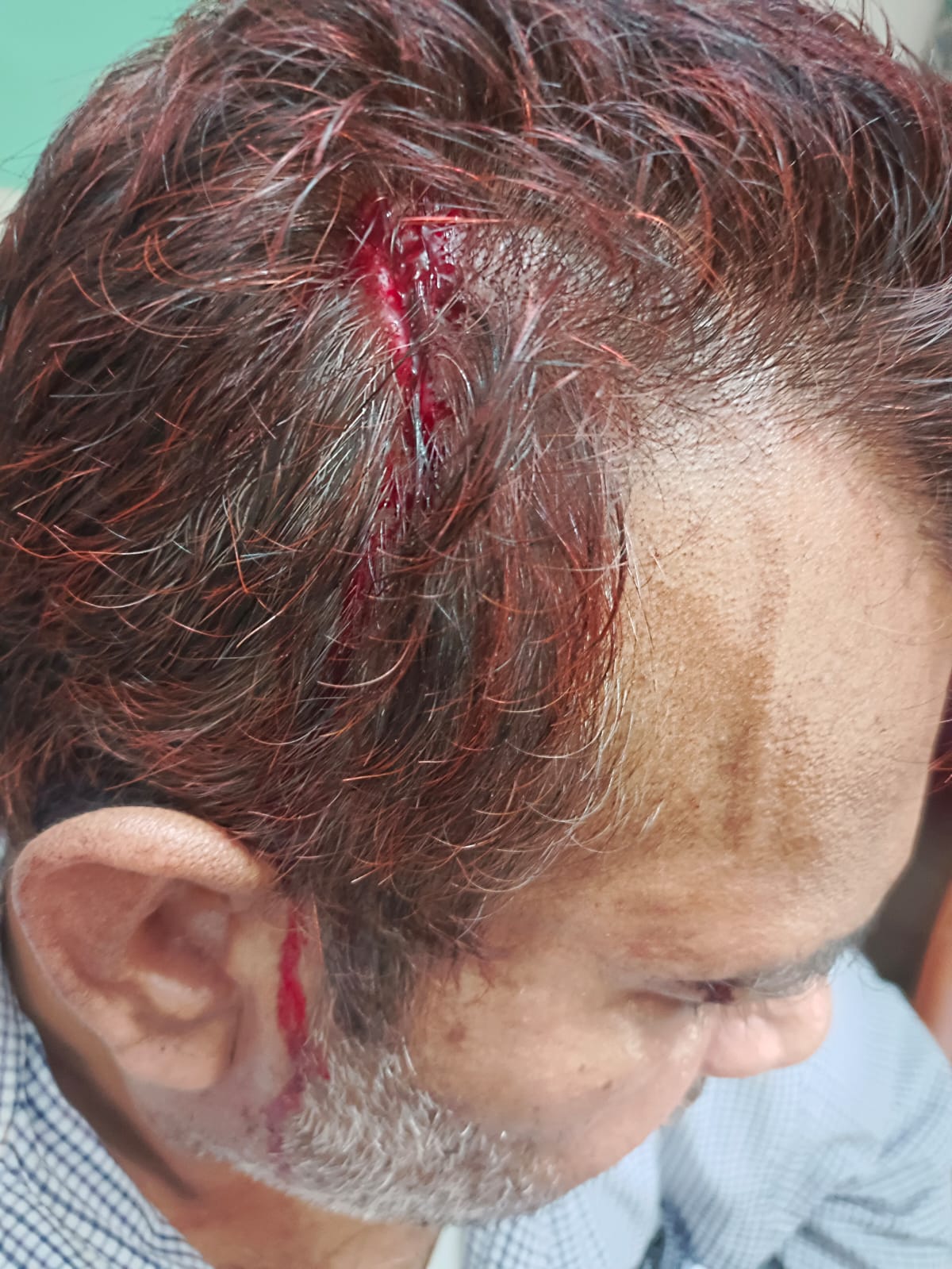 নাকোলে শতবর্ষী বিদ্যালয়ে হামলা, প্রধান শিক্ষক আহত