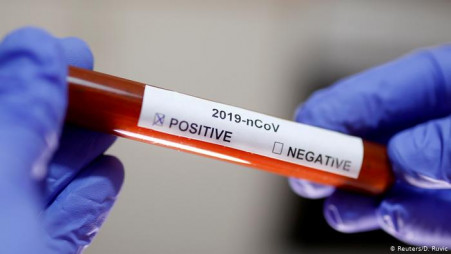 Covid-19 patients no longer infectious 11 days after getting sick