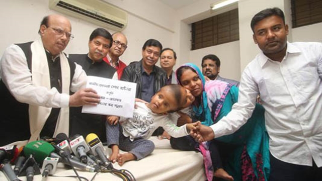 Conjoined twins leave for Hungary tonight